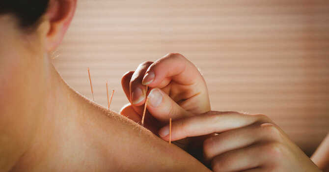 Dry Needling
